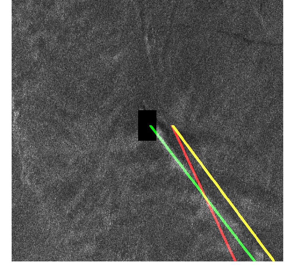 Figure 34